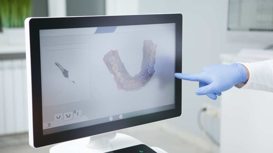 intraoral camera